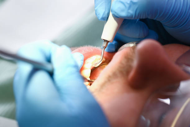 Best Emergency Treatment for Dental Infections or Abscesses in Campbellsville, KY